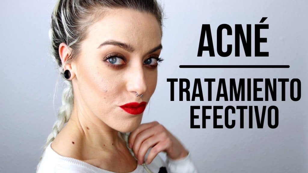 acne quistico