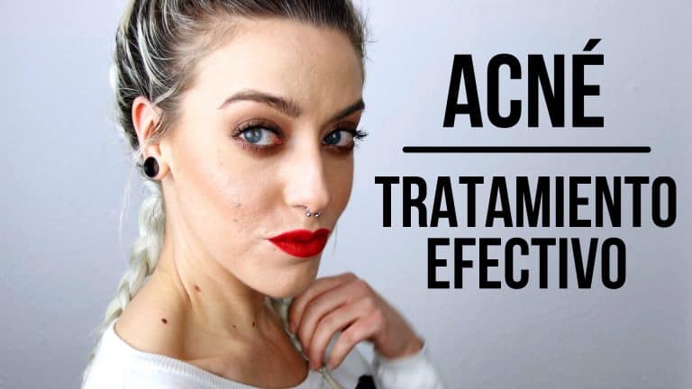 acne quistico